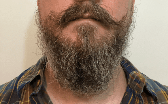 Beard with Honest Amish Beard Balm In It