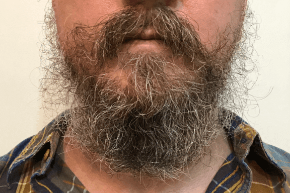 Beard Before Honest Amish Beard Balm