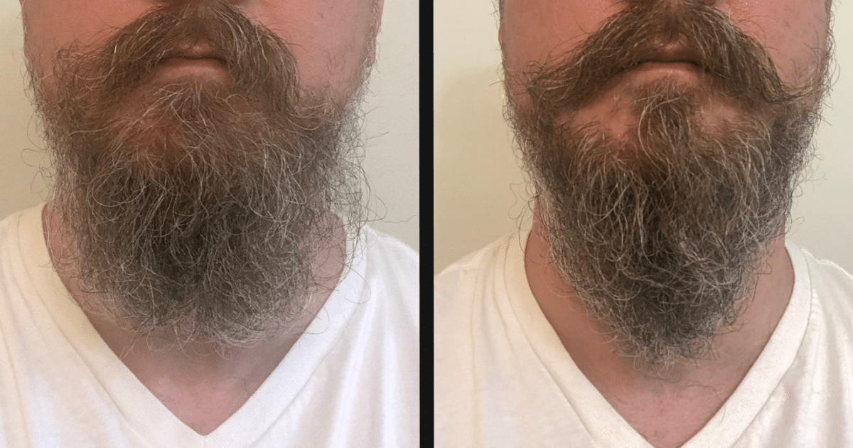 Beard Balm Before and After