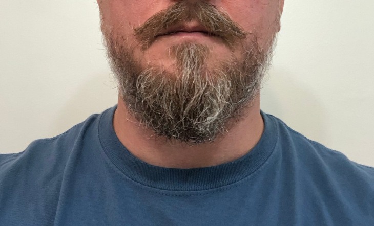 After Beard Oil (short beard)