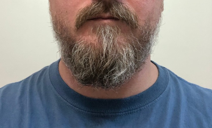 Before Beard Oil (short beard)