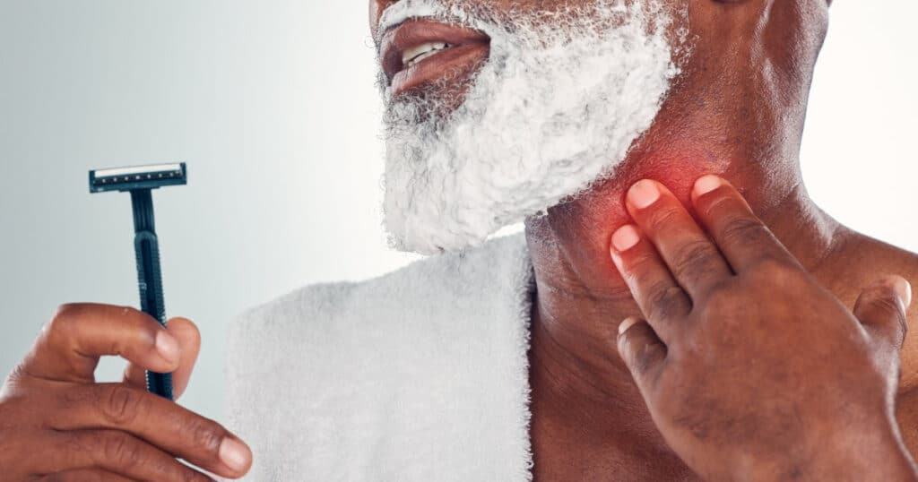 How to Prevent Razor Burn When Shaving