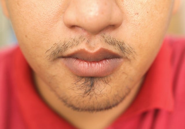 Reasons for Poor Mustache Growth